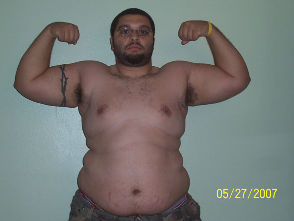 Before Picture 2