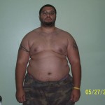 Before Picture 3