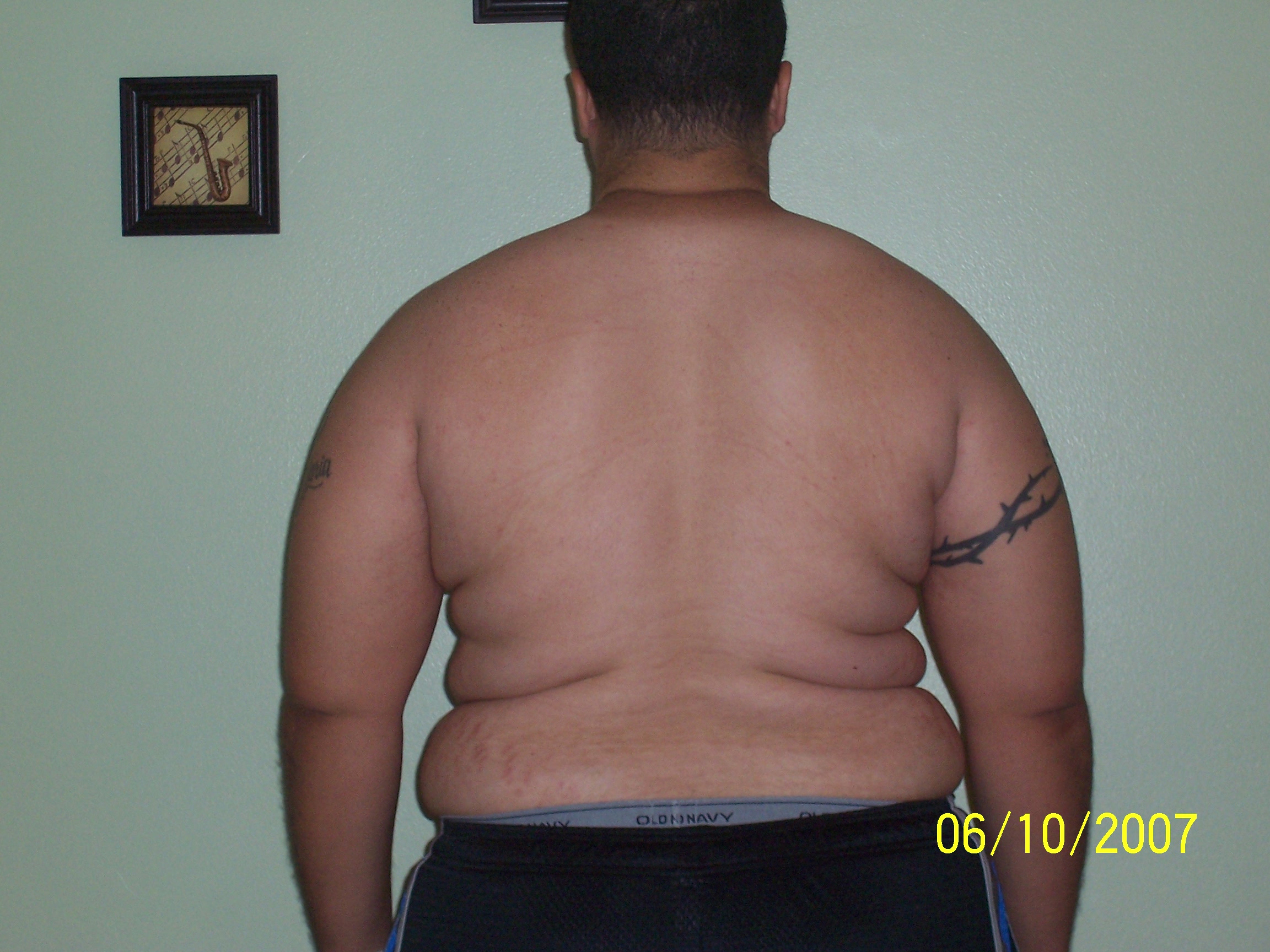Fat On The Back Of 106