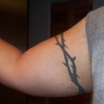 Stretch Marks on my arms