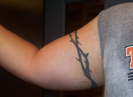 I just couldn't let myself post the pictures of the stretch marks on my back I just couldn't let myself post the pictures of the stretch marks on my back