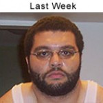Did I lose weight in my face?