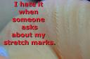 Are Stretch Marks Haunting You?