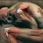 pain map